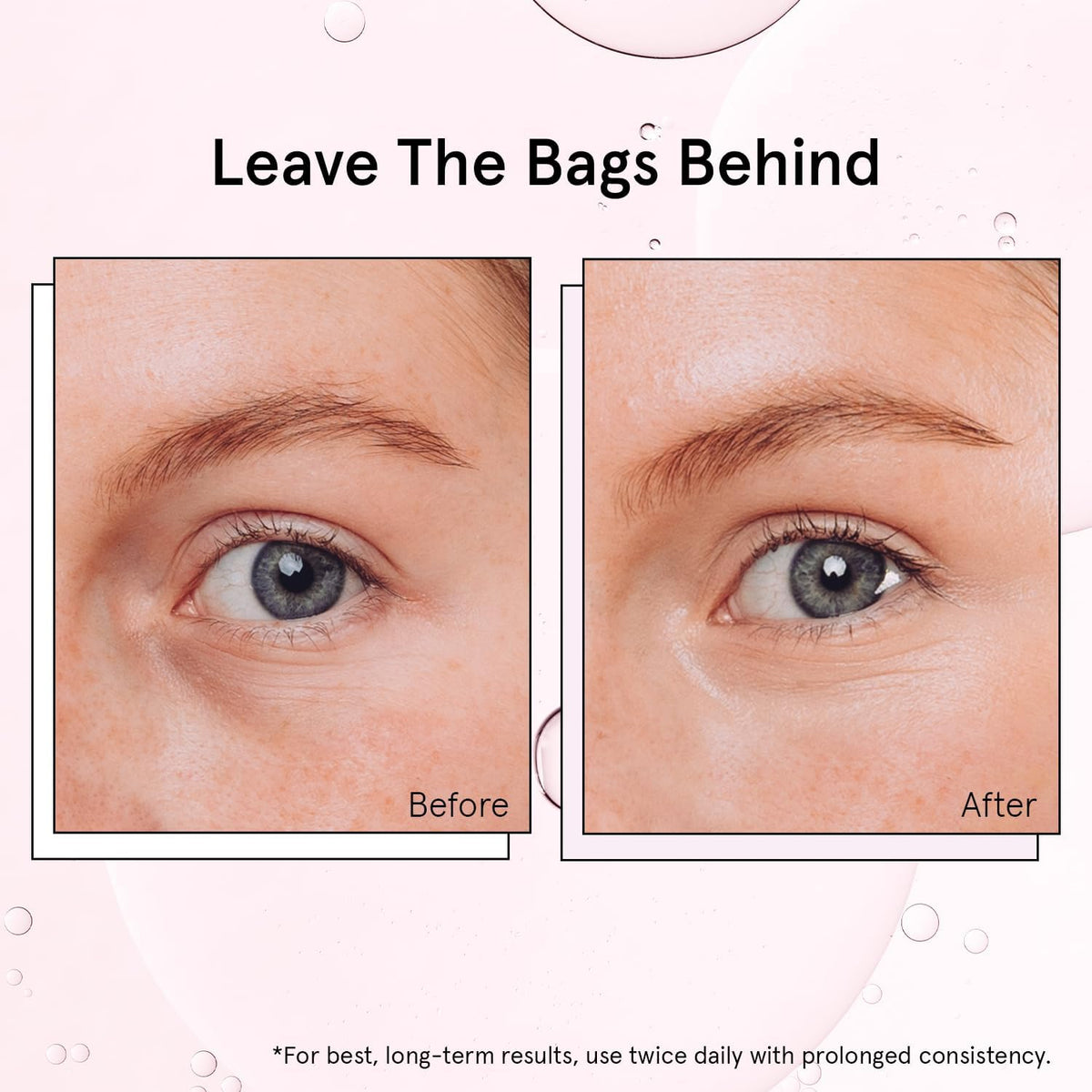 Award Winning under Eye Brightener Roller