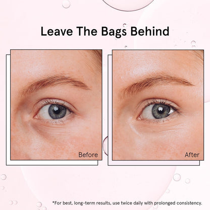 Award Winning under Eye Brightener Roller